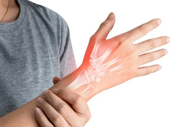 Carpal Tunnel Syndrome self-care