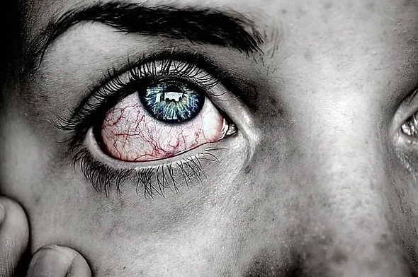 red eyes