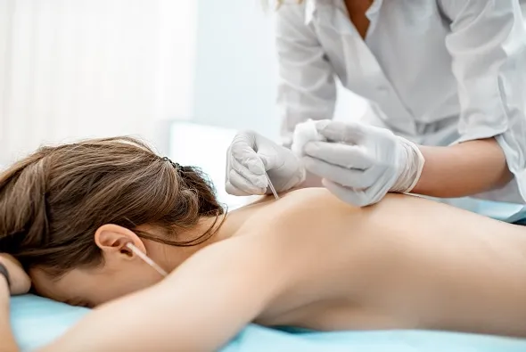 acupuncturing girl