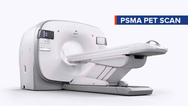 Psma machine