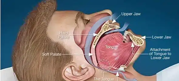 Benefits of PAP therapy for better sleep