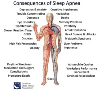 Using CPAP for improved sleep quality
